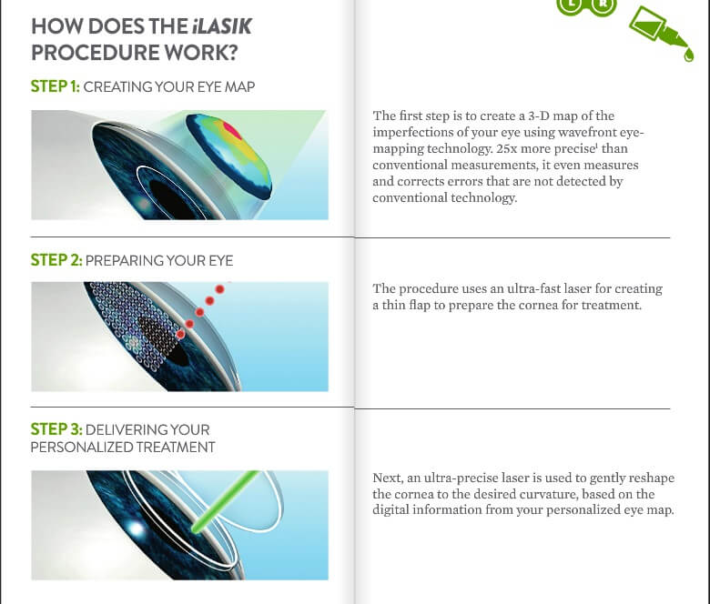 Graphic Showing How iLASIK Works